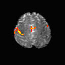 Functional magnetic resonance image ( fMRI ).